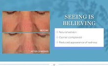 Afbeelding in Gallery-weergave laden, Hydropeptide Soothing Calming Serum